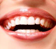 Gengivoplastia Odontologia